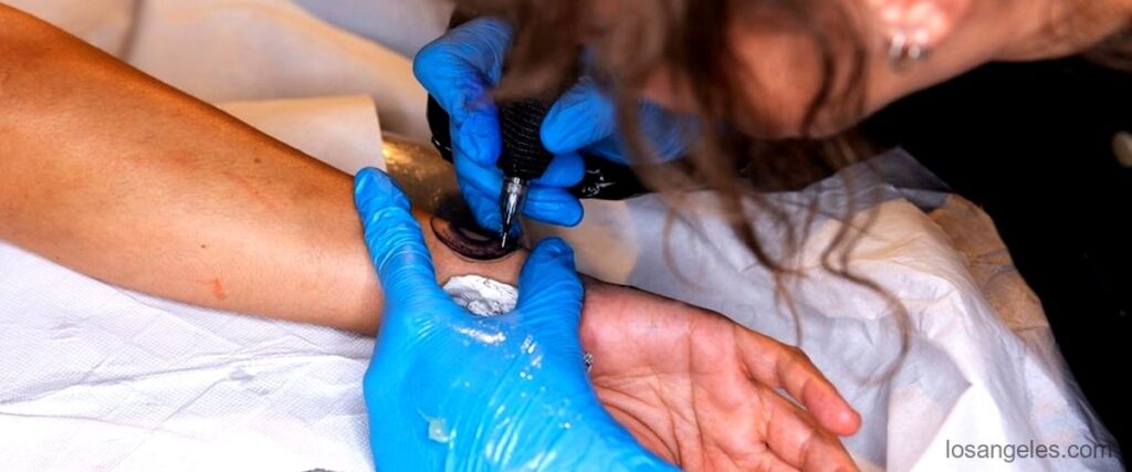 The 5 Best Tattoo Removal Services in Los Angeles